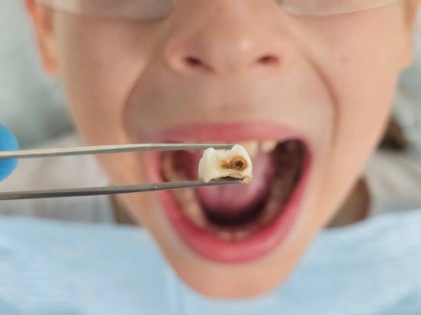 Best Emergency Denture Repair in Gamerco, NM