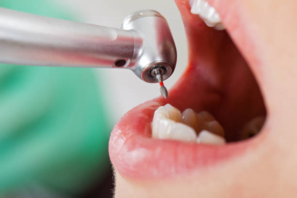Best Emergency Treatment for Dental Infections or Abscesses in Gamerco, NM